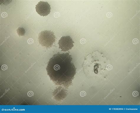 Round Shaped Candida Albicans Colonies Under The Microscope Stock Photo