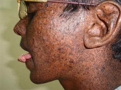 Rare Health Problems That Are Shocking And Stunning