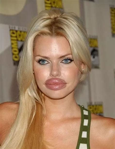 These 15 People Are Definitely Unemployed Cosmetic Surgery Big Lips
