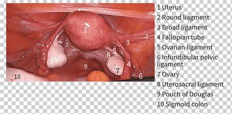 Learn more about the pelvis in this article. The Female Pelvis Anatomy & Exercises Laparoscopy ...