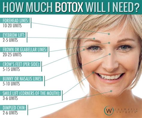 Learn how much botox is will be needed to achieve your desired results! Botox Eyebrow Lift Injection Sites botox philadelphia ...