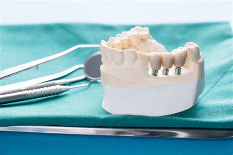 Full Fixed Or Removable Dental Implant Restorations Which Is Right For