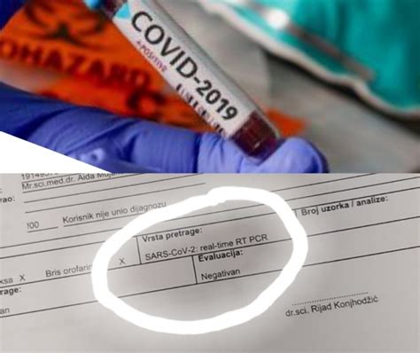 Privatna laboratorija pacijentu dala nalaz da je negativan na COVID-19, u KCUS-u utvrđeno da je ...