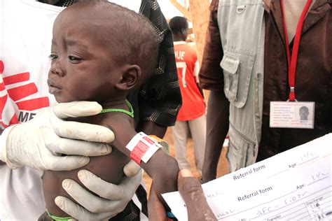 The New Humanitarian Malnutrition The Main Challenge In Karamojas