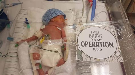 These Milestone Cards Are Great For Families With Preemies