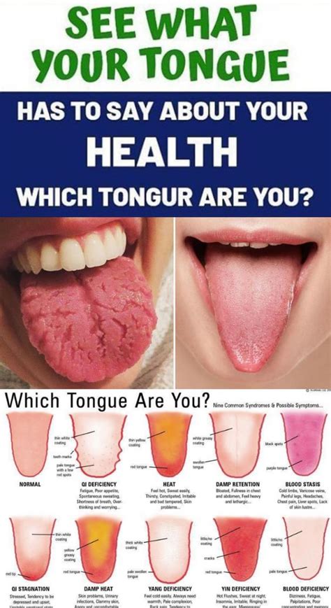 What Is Your Tongue Telling You About Your Health Baatoboodan