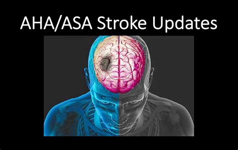Emergency Medicine Education2018 Ahaasa Ischemic Stroke