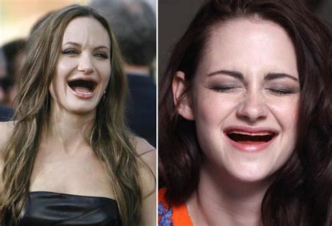 Celebrities Without Teeth Tumblr