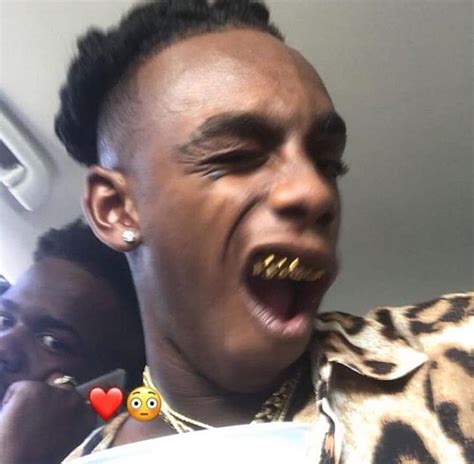 A Man With His Mouth Open And Gold Teeth