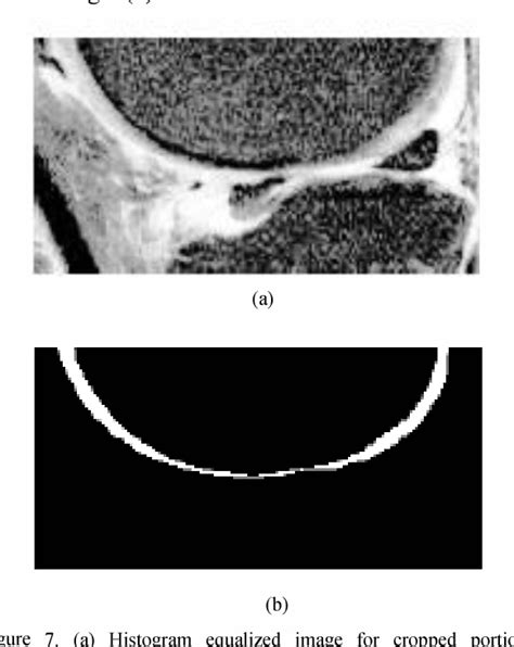 Knee Joint Cartilage Visualization And Quantification In Normal And