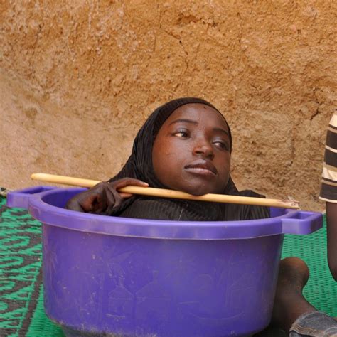 The Girl Who Lives In A Bowl A Teenage Girl Born Without Limbs Lives