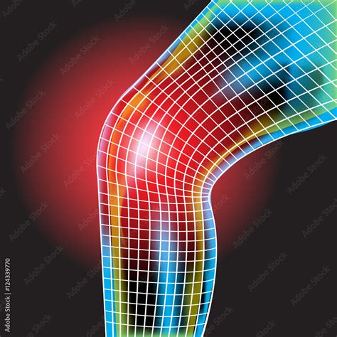 Knee Pain X Ray Knee Scan Stock Vektorgrafik Adobe Stock