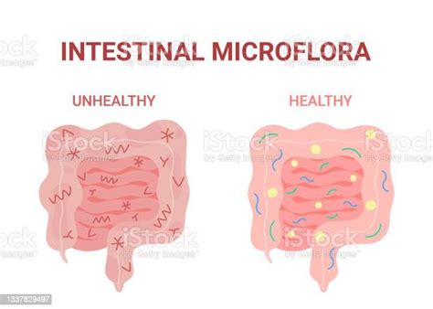 Ilustración De Microflora Intestinal Saludable Y No Saludable Intestino