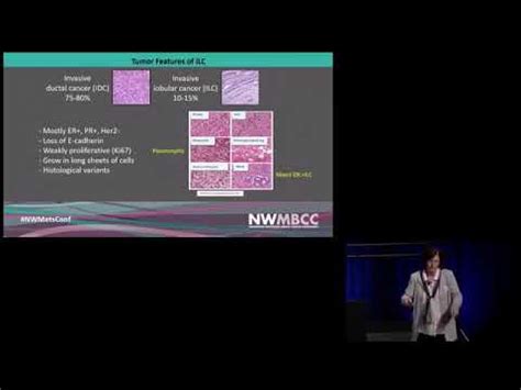 However, if proper attention is given and diagnosis of the liver cancer is detected at the earlier stages of the cancer then the survival rate of the patient increases a lot. Lobular Breast Cancer: How is it different from IDC and ...