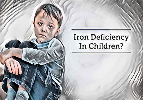 Iron Deficiency Anemia In Children Causes Clinical Manifestation