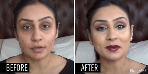 How To Hide Acne With Makeup For Guys Mugeek Vidalondon