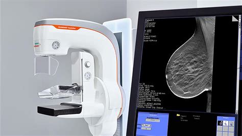 Wide Angle Breast Tomosynthesis Siemens Healthineers Usa
