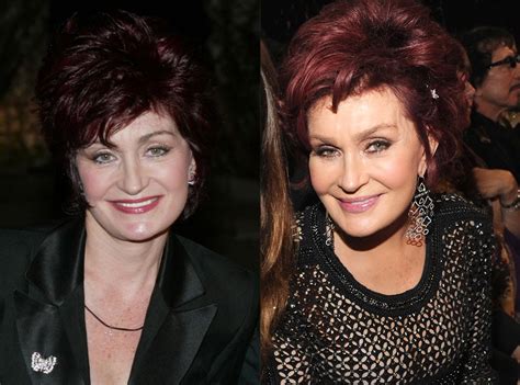 Sharon Osbourne From Better Or Worse Celebs Who Have Had Plastic