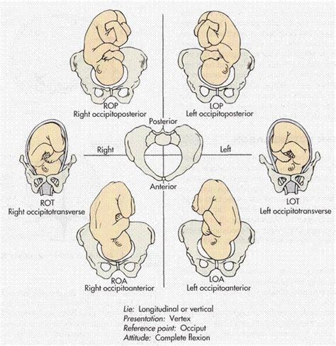 Fetal Positioning Baby Position Newborn Nursing Midwifery