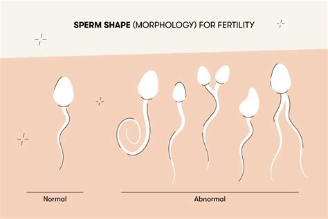 how much sperm does it take to get pregnant semen quality explained