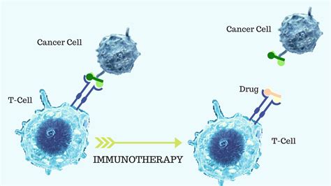 Is Cell Based Immunotherapy A Realistic Prospect To Treat Cancer