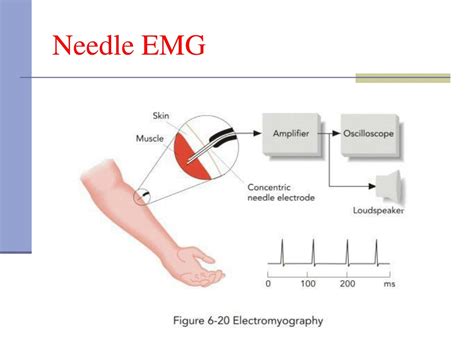 Ppt Electromyography Emg Powerpoint Presentation Free Download
