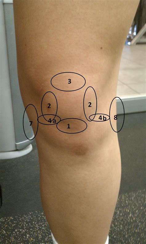 The longitudinal tears are generally left alone, as studies have shown that surgically trimming those usually does little. Dr. David Kwon's Blog: Ouch! My Knee Hurts!!! Part 1