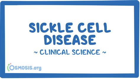 Sickle Cell Disease Clinical Sciences Osmosis Video Library