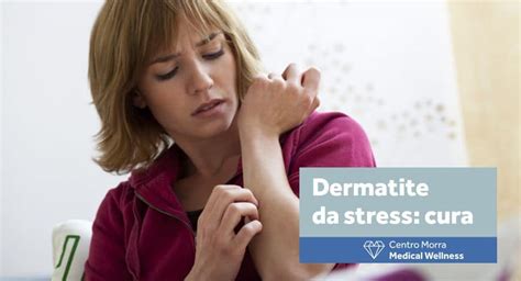 Dermatiti Da Stress Cura Napoli Centro Morra