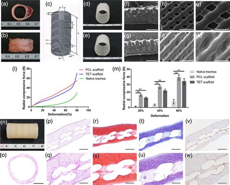 Reconstructed Tissue Engineered Trachea Tet In Vitro And Primary Download Scientific Diagram