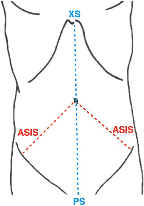 Three Measurements Were Taken From Landmarks On The Abdominal Surface