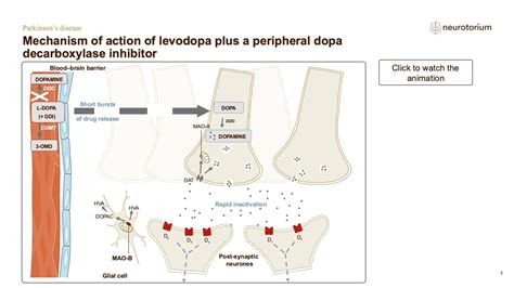 Parkinsons Disease Treatment Principles Neurotorium