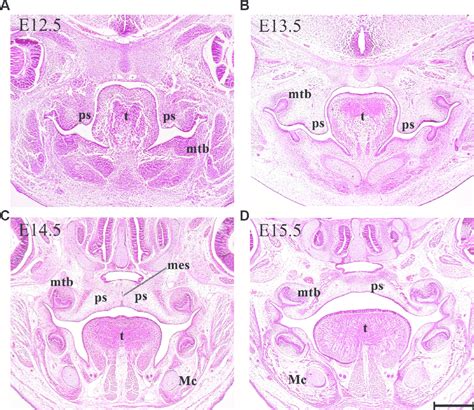 Palatogenesis In The Mouse Representative Histological Frontal