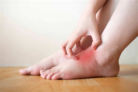 What Causes A Rash On My Feet Vrogue Co