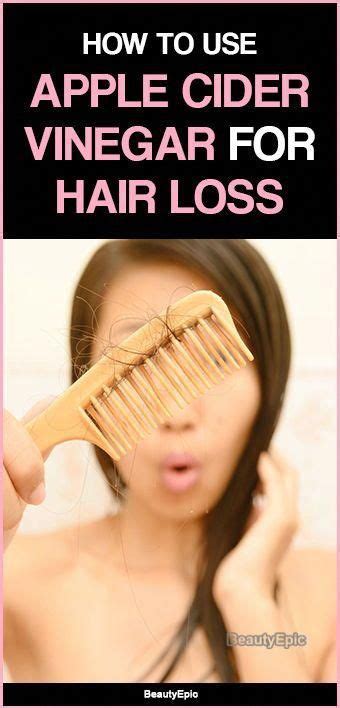 Let's talk hair loss and thinning hair. Apple Cider Vinegar for Hair Loss | Vinegar for hair ...