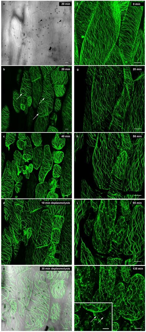Check spelling or type a new query. Plants | Free Full-Text | Plasmolysis: Loss of Turgor and ...