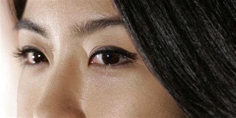 No Asian Eyelid Surgery Is Not About Looking More White Business