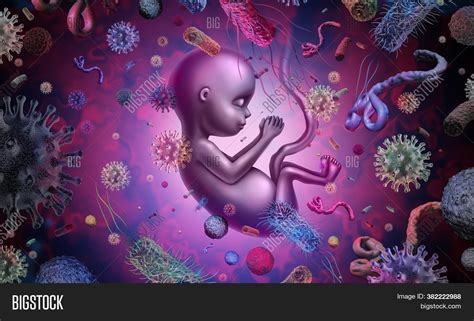 Fetus Infectious Image And Photo Free Trial Bigstock