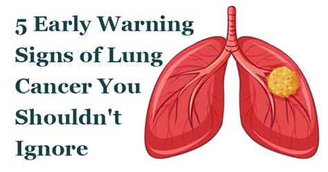 Some people have symptoms related to the lungs. 5 Early Warning Signs of Lung Cancer You Shouldn't Ignore ...