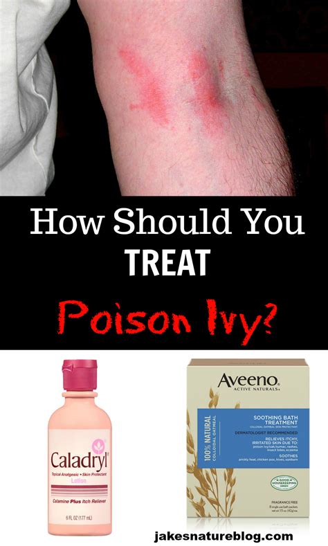 What Is Best For Poison Ivy Rash