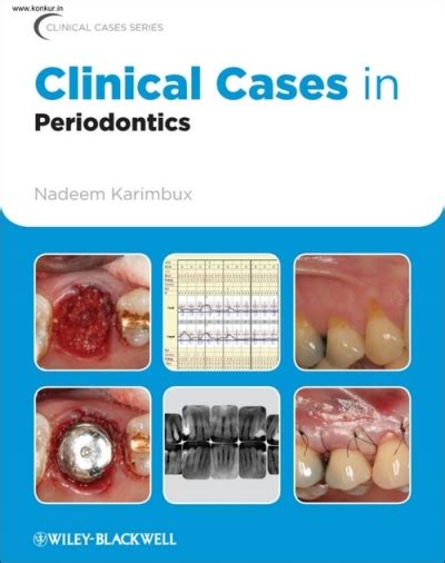 Clinical Cases In Periodontics St Edition Konkur In