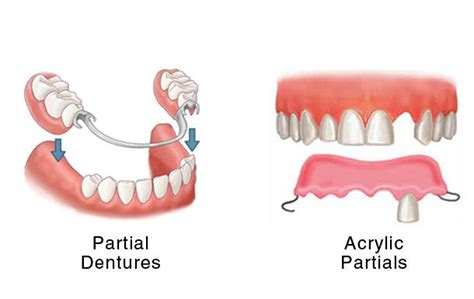 How to maintain your false teeth. I have been in need of getting dentures soon, and have ...