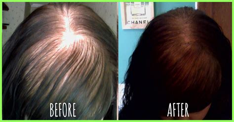 Table of contents how to stop hair fall naturally bonus tips for how to stop hair fall How To Stop And Reduce Hair Fall - 14 Things That Worked ...