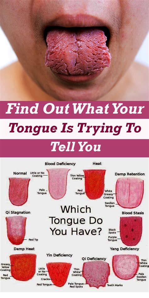 What Is Your Tongue Telling You About Your Health Healthy Wellness 101
