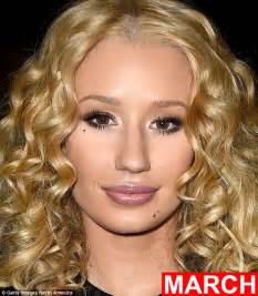 iggy azalea before and after photos show plastic surgery transformation daily mail online