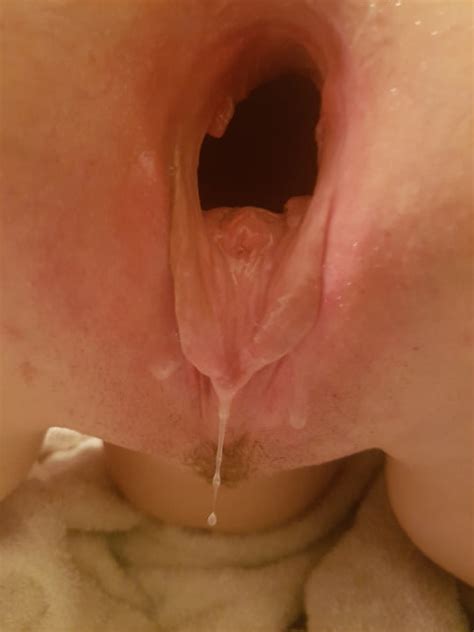 Huge Gaping Hairy Cunt 23 Pics Xhamster