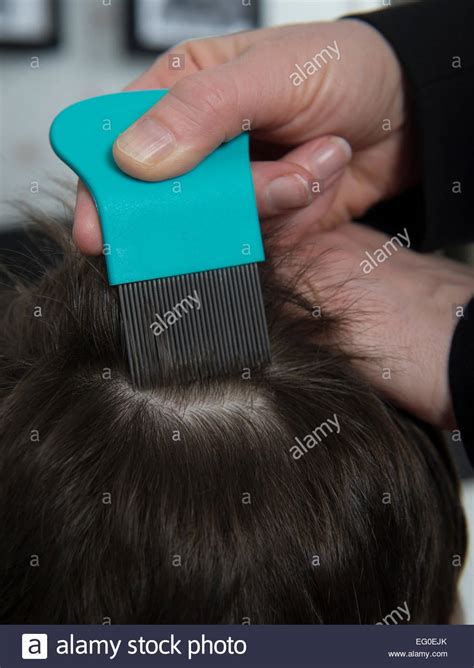 Hair For Head Lice Hi Res Stock Photography And Images Alamy