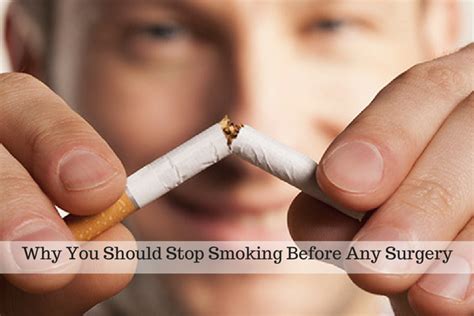 Why You Should Stop Smoking Before Any Surgery