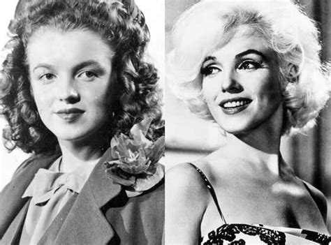 Marilyn Monroes Medical Records And X Rays Confirm Plastic Surgery
