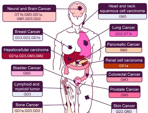 Each Species Of Cancer In The Human Body And Related Gangliosides As